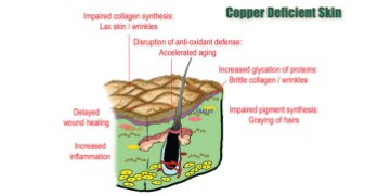 Copper_chaptergraphic1_copperdeficiency